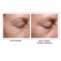       Gezatone Palovia Laser Palomar